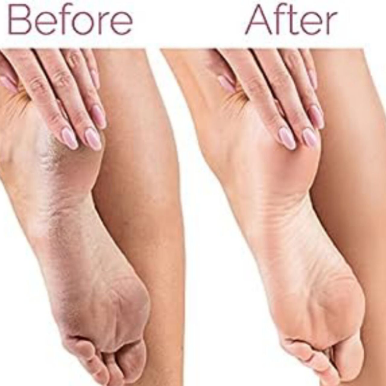 أداة باديكير للعناية بالقدمين  Finishing Touch Flawless Pedi